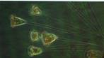 Vorticella